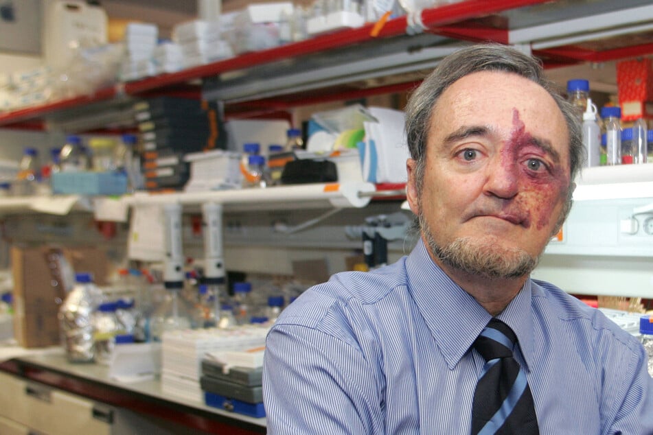 Durchbruch in der Krebsforschung? Arzt heilt aggressiven Tumor bei Mäusen