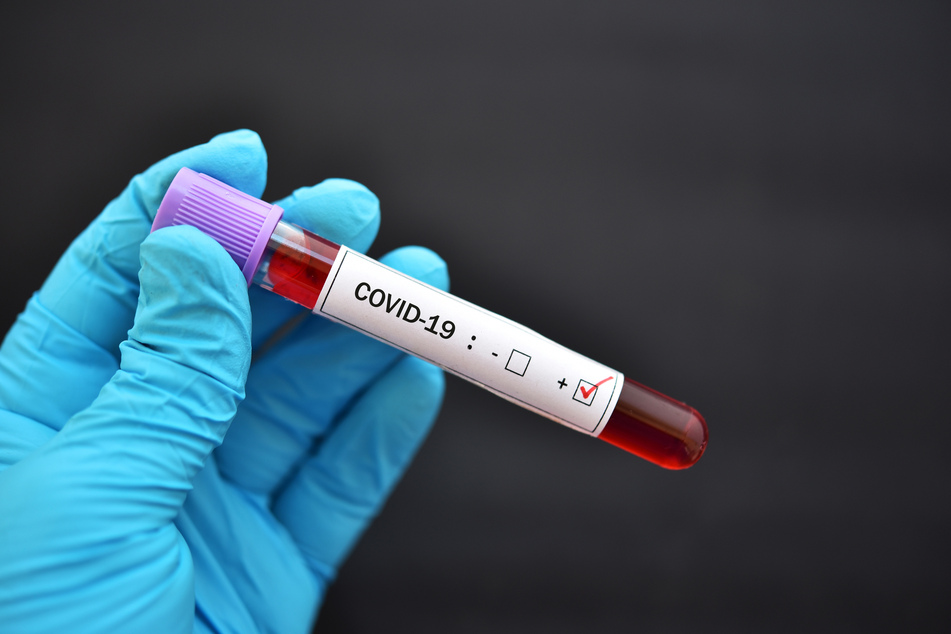 Nach Ansicht der Biologen könnte die nächste Epidemie das Coronavirus noch in den Schatten stellen.