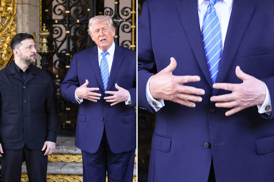 Trump spotted with fresh bruising on left hand, reviving questions over health