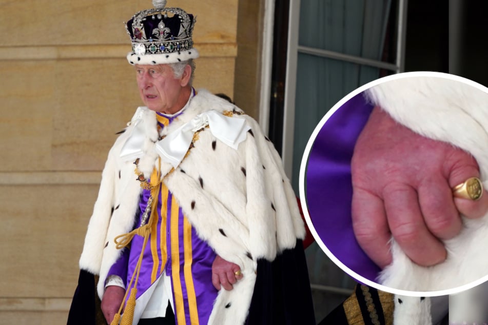 "Wurstfinger": Was ist mit der Hand von König Charles III. passiert?