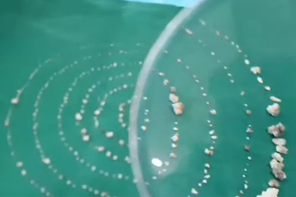 Die entfernten Zähne des kleinen Jungen aus Indien.