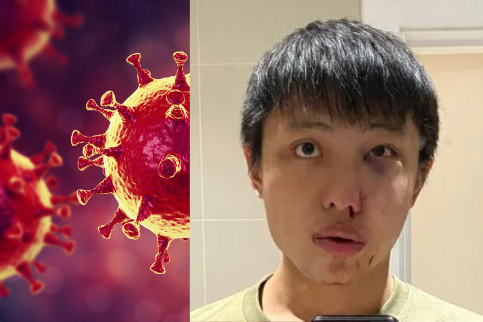 Rassisten nutzten das Coronavirus als Vorwand, um ihren Fremdenhass auszuleben.