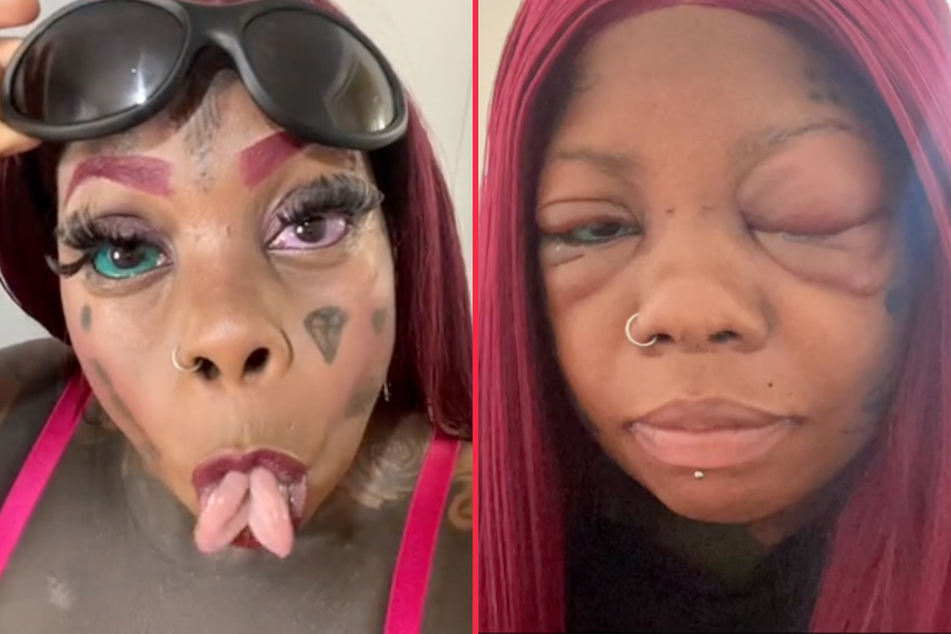 Woman going blind from eye tattoos says she will never quit getting inked