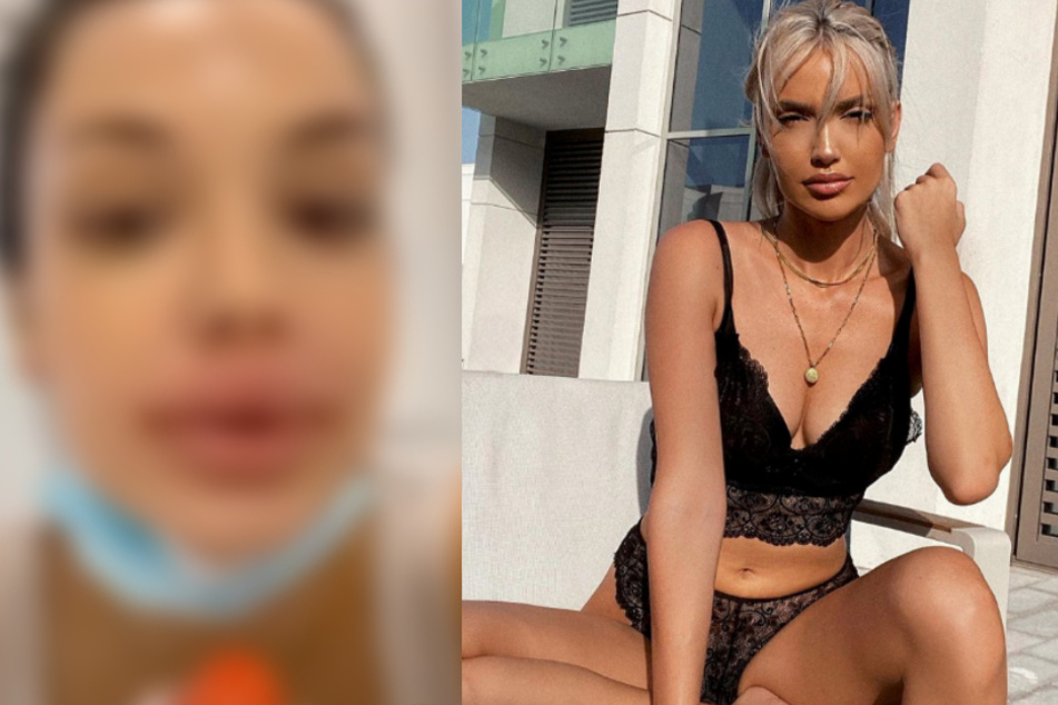 Enisa Bukvic: GNTM-Babe Enisa bereut Beauty-Eingriff: "Kann mich selbst nicht mehr anschauen!"
