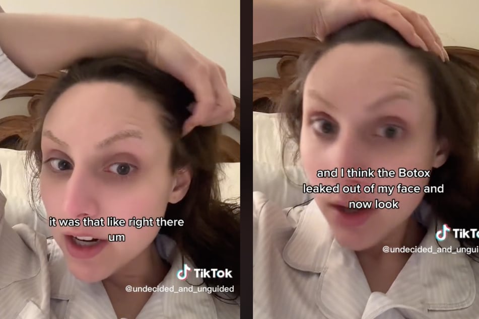 Die TikTokerin vermutet, dass sie ihr frisch gespritztes Botox wieder aus ihrem Gesicht gedrückt hat.