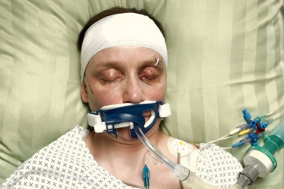 Sarah (Mareike Sedl, 49) kämpft nach dem Autounfall im Krankenhaus um ihr Leben.