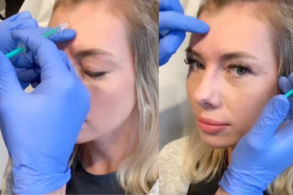 Janika ließ ihre Stirn Anfang Dezember mit Botox behandeln.