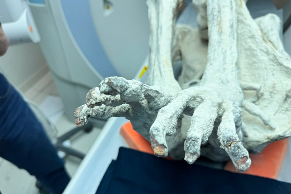 The mummies only have three toes.