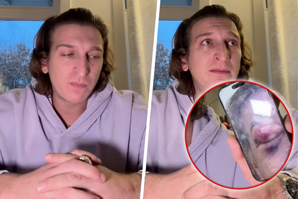 "Erkennen unseren Vater kaum": Reality-Star bittet Fans nach brutaler Prügelattacke um Hilfe