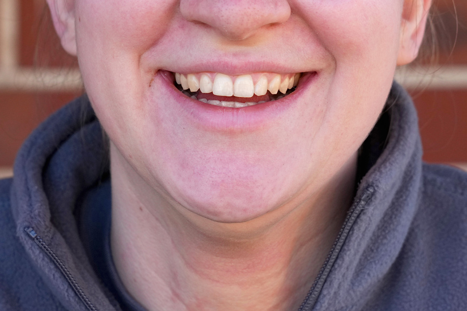 Eine junge Frau lacht. Die Anspannung von Gesichtsmuskeln, wie sie für ein Lächeln üblich ist, macht Menschen ein wenig glücklicher.