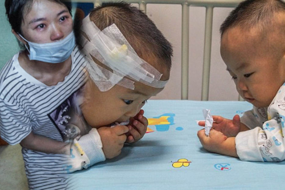 Eltern lassen ihre Kinder Lose ziehen, weil sie sich Behandlung von beiden nicht leisten können