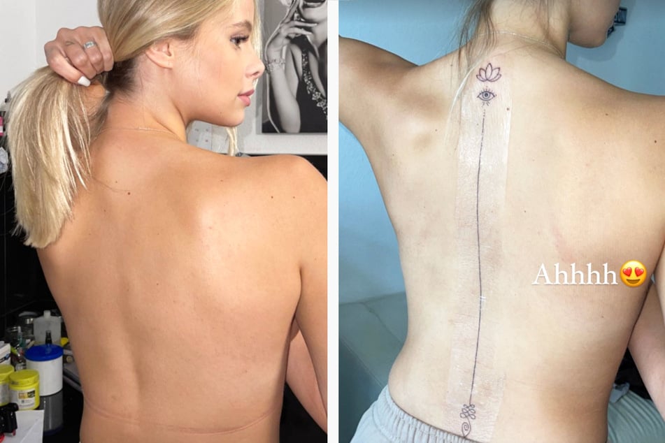 In ihren Instagram-Storys zeigte Larissa Neumann (21) wie versprochen Vorher-Nachher-Aufnahmen ihres Rückens.