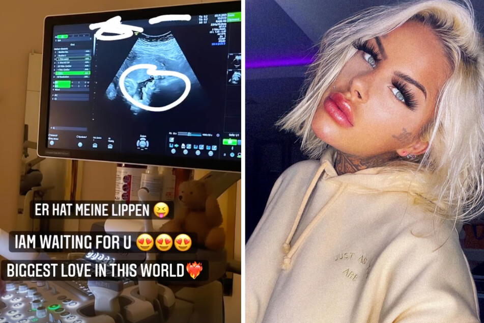 Leoni Baltz (23) veröffentlichte ein verdächtiges Ultraschall-Bild aus einer Arztpraxis.