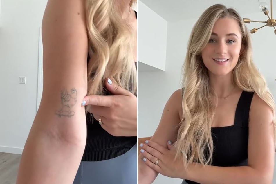 Raimee Iacofano aus Los Angeles hat ein Problem mit ihrem Tattoo.