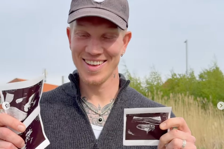 Überglücklich zeigt Simon Makienok (34) die Ultraschallbilder.