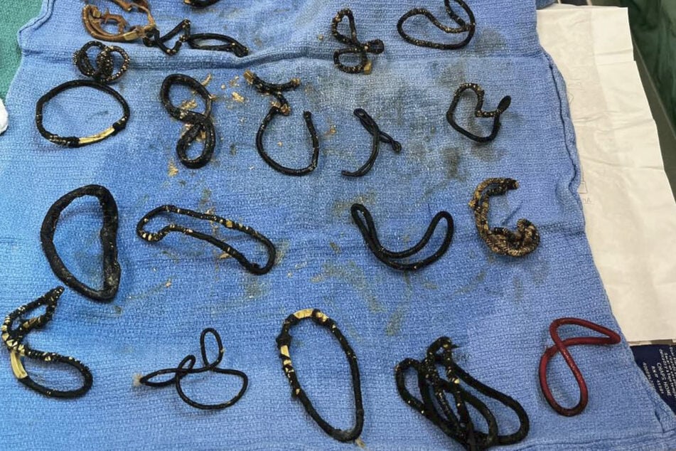 Ganze 26 Haargummis fanden die Tierärzte im Magen der todkranken Katze.