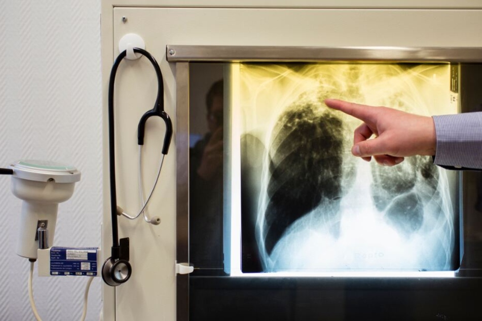Eine Frau und ein Mann mussten in einem Krankenhaus behandelt werden. (Symbolbild)