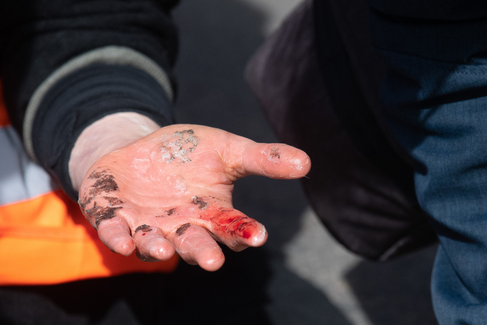 Ein Demonstrant hält während eines Protests der Gruppe "Letzte Generation" seine blutende Hand hoch, nachdem diese von der Straße gelöst wurde. Der Demonstrant hatte sich mit Sekundenkleber auf der Fahrbahn festgeklebt. Die Gruppe fordert einen sofortigen Stopp aller Investitionen in den neuen Ausbau von fossiler Infrastruktur.