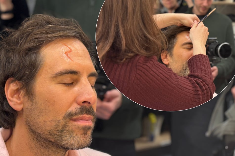 Während seines Cast-Besuchs durfte auch Max Giesinger Maskenluft schnuppern und ließ sich die berühmte Harry-Potter-Narbe schminken. Diese wird extra stark und deutlich größer als "echte Narben" geschminkt, damit sie noch aus der letzten Reihe gut zu sehen ist, so Maskenbildnerin Maren Hoffmann.