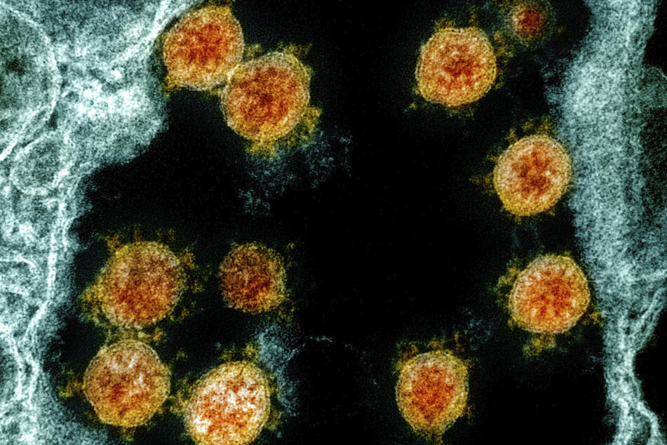 Die elektronenmikroskopische Aufnahme aus dem Jahr 2020 wurde farblich bearbeitet und zeigt Partikel des Coronavirus SARS-CoV-2, (in Orange), die von einem Patienten isoliert wurden.
