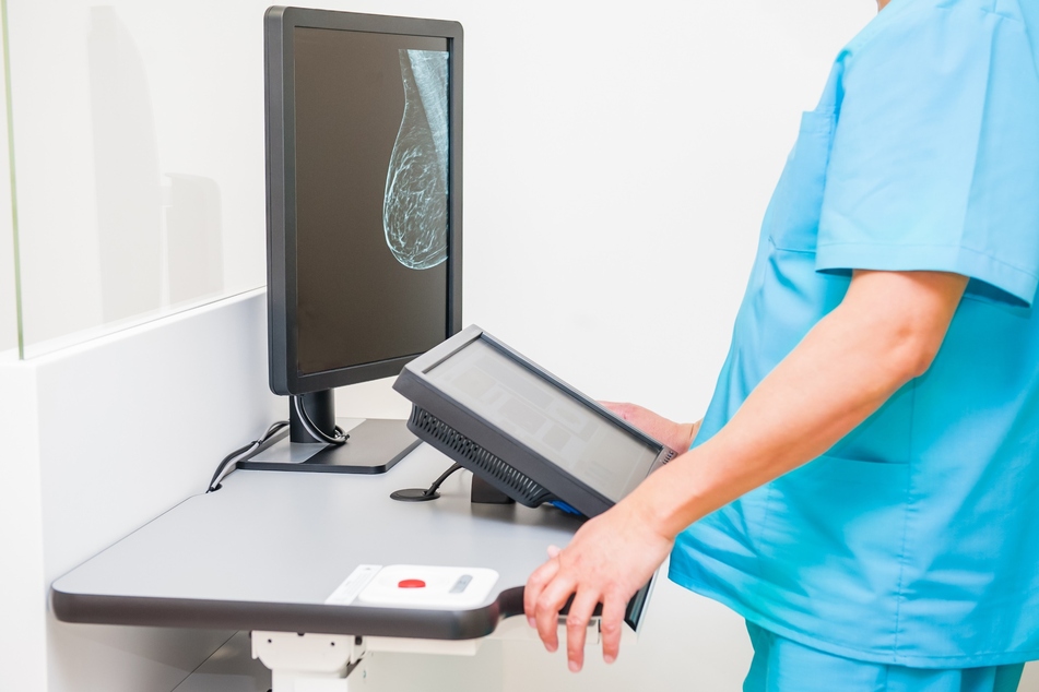 AI-supported breast screenings helped reduce a radiologist's work by 50%, according to a new scientific study.