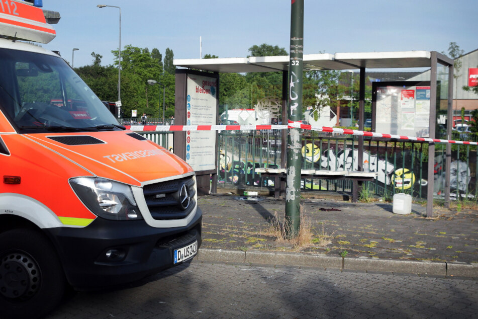 Der 70-Jährige stand an einer Bushaltestelle plötzlich in Flammen.