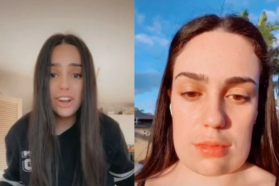 Sofia Marroquin (19) sieht nach einem kosmetischen Eingriff komplett anders aus.