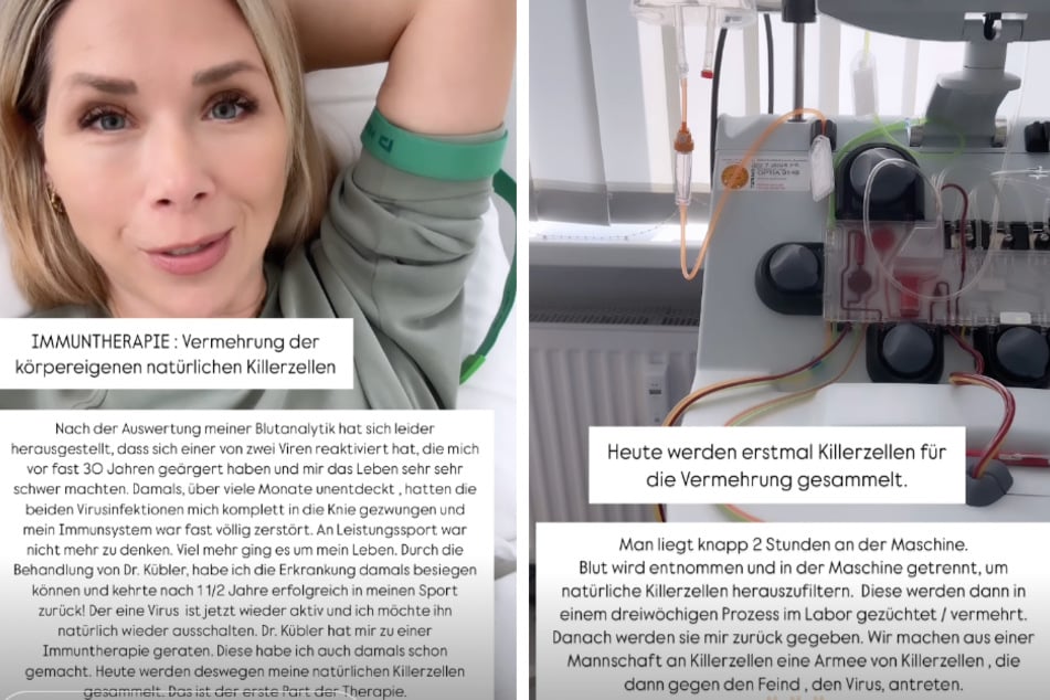 Bei Instagram erklärte Tanja ihren Fans das Vorgehen während der Therapie.