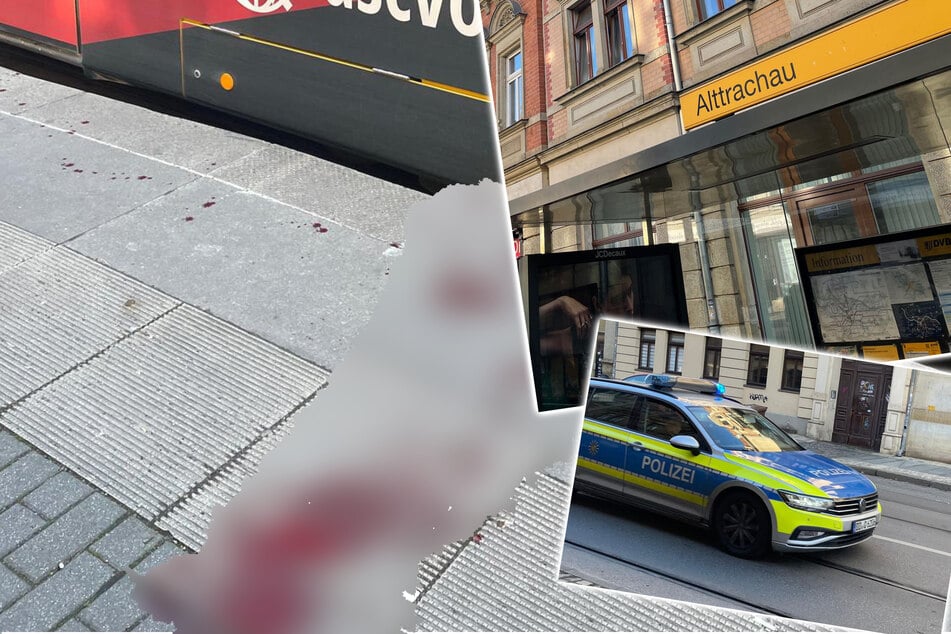 Dresden: Brutale Attacke in Dresden-Mickten: Nun sucht Polizei nach Zeugen