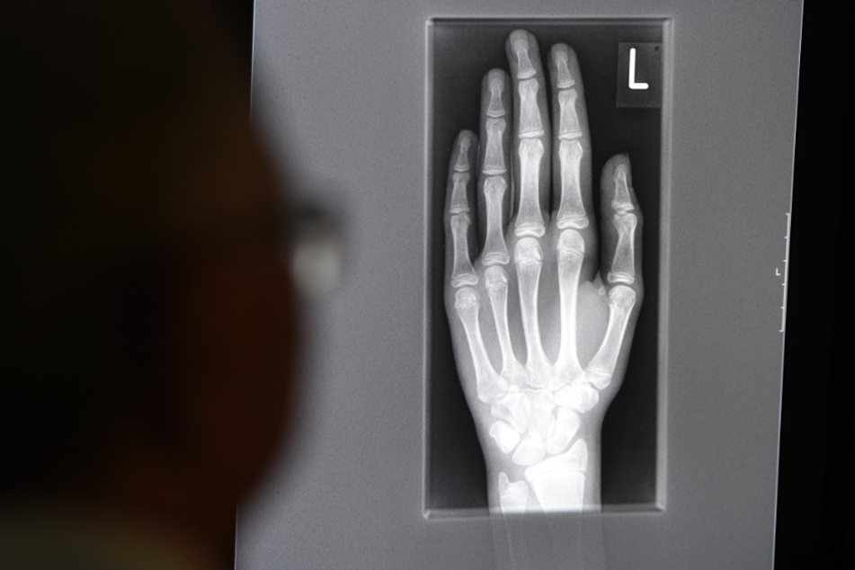Über die radiologische Untersuchung des Handwurzelknochens und der Hand lässt sich das etwaige Alter eines Menschen bestimmen.