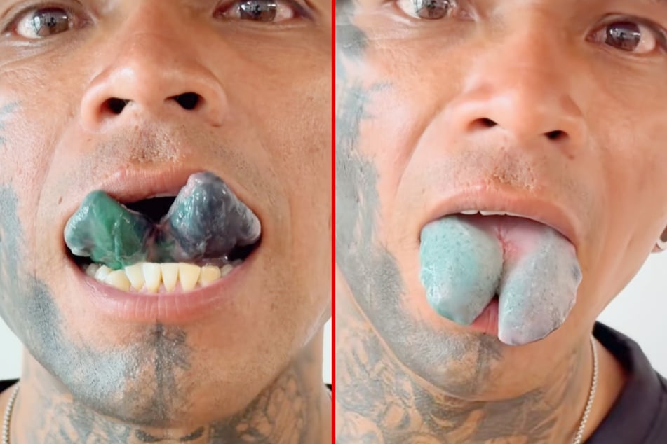 This body modification addict chopped his tongue in half and tattooed it blue.