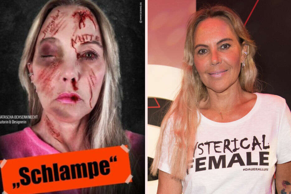 Natascha Ochsenknecht schockt Fans mit Anti-Mobbing-Foto