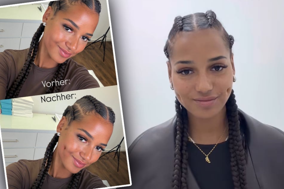 Die 22-Jährige unterzog sich kürzlich einem ungewöhnlichen Schönheits-Eingriff und ließ sich künstliche Grübchen operieren.