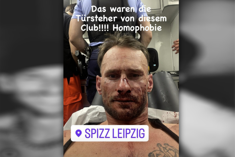 Unter anderem mit diesem Foto schockierte Robert Hebestreit am Sonntagmorgen seine Instagram-Follower. Zuvor war es offenbar im Leipziger "Spizz" zu einer Auseinandersetzung zwischen ihm und der Security gekommen.