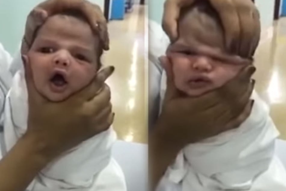 Immer wieder drückt die Krankenschwester das Gesicht des Babys zusammen.