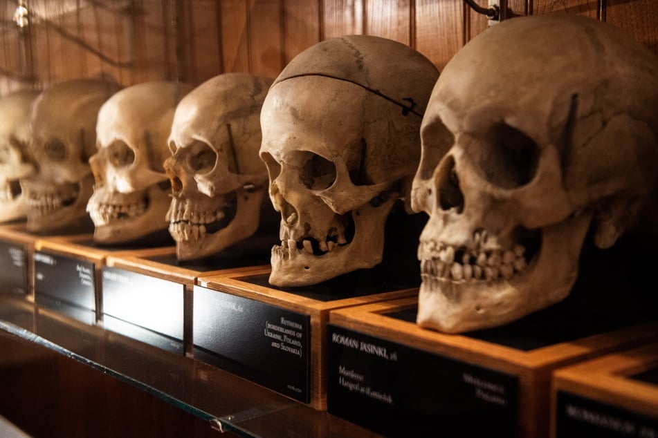 Skulls from the Josef Hyrtl Collection are on display at the Mutter Museum.
