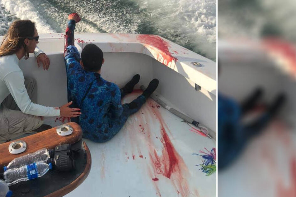 Schwer verletzt sitzt der Taucher im Fischerboot und wird von seinem Retter gestützt.