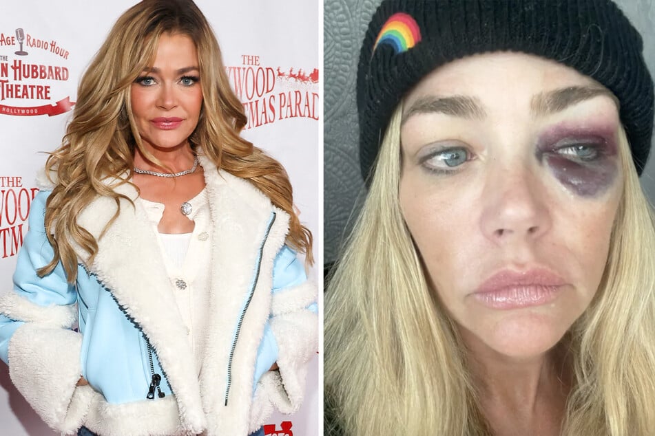 Golpeada en la cabeza con un toallero: estrella de Hollywood acusa a su ex esposo de graves delitos