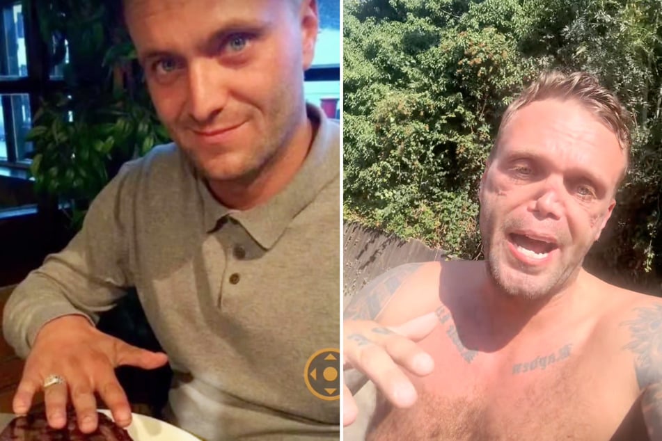 Die jahrelange Sucht nach Kokain veränderte Shane Samler (38) aus Essex auch äußerlich.
