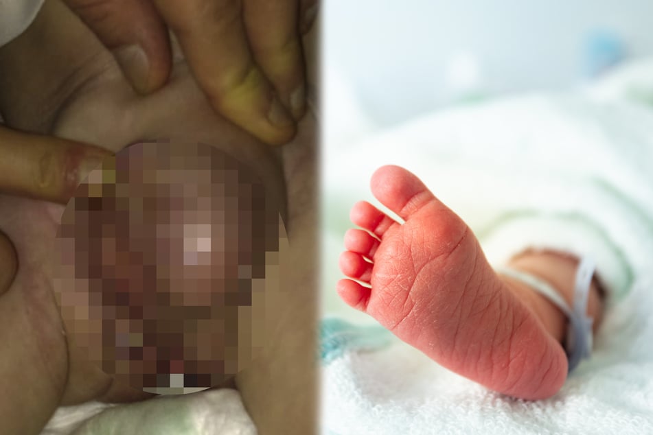 Das gab es weltweit noch nie: Ärzte sind sprachlos, als sie Genitalbereich eines Babys sehen
