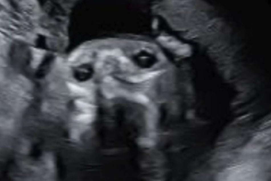 Beim Organscreening des ungeborenen Kindes entstand dieses Bild. Den Eltern fiel auf, dass sie ihnen dieser Anblick irgendwie bekannt vorkam ...