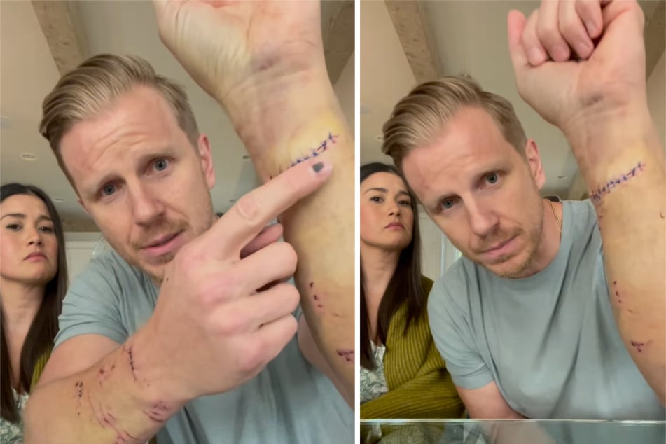 The Bachelor star Sean Lowe has shared a new video revealing that he was recently attacked by his rescue dog in a "traumatic" incident.