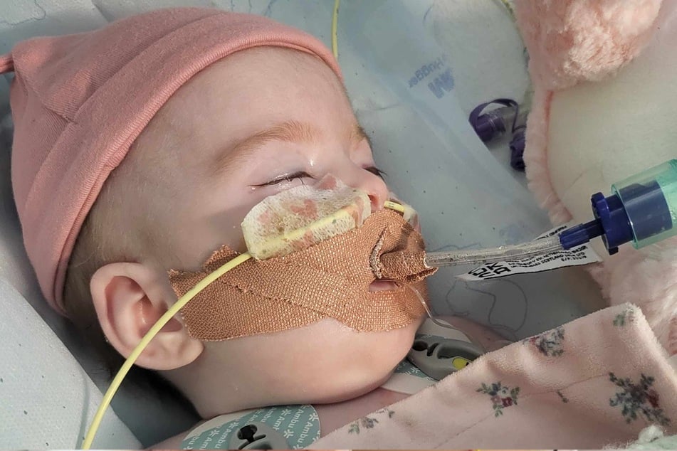 Die sieben Monate alte Indi Gregory hat seit ihrer Geburt das Krankenhaus nicht verlassen und wurde bereits zweimal operiert.