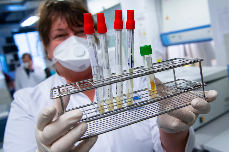 Eine Mitarbeiterin am Institut für Virologie der technischen Universität München (TUM) bereitet Proben von Menschen mit Covid-19-Verdacht in einem Labor für die weitere Analyse vor.