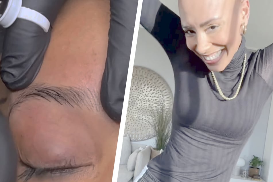 In einem Video dokumentierte die Ex-"Bachelorette" die Behandlung (l.) und präsentierte das Ergebnis danach (r.).