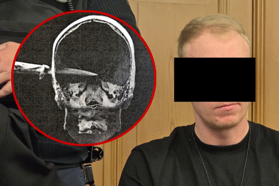 Er rammte seinem Opfer ein Messer in den Kopf, nun muss er lebenslänglich hinter Gitter