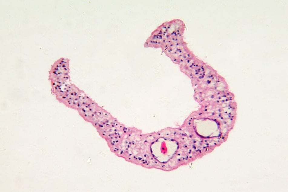 Eine mikroskopische Aufnahme des menschlichen Parasit Schistosoma mansonii , der Bilharziose verursacht, woran James litt.