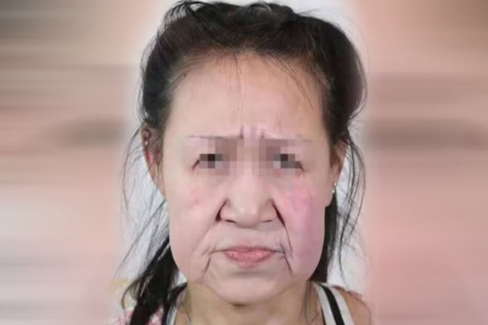 Das "Shenyang Sunline Plastic Surgery"-Krankenhaus veröffentlichte die Bilder von Xiao Feng (15) nur mit leicht gepixelten Augen.
