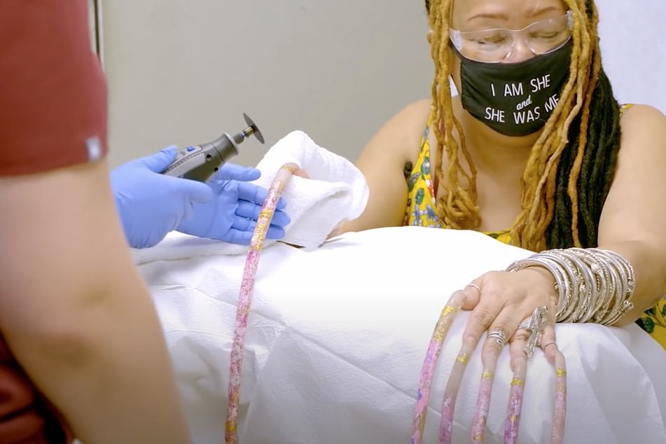 Cutting the nails off took some effort: the physicians used an an electric rotary tool.