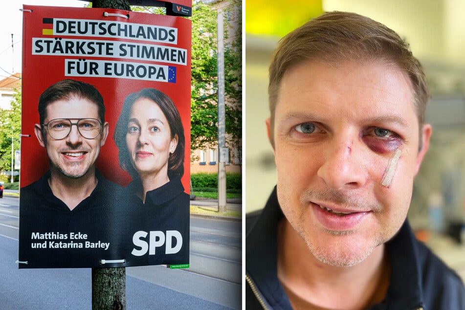 Von Rechten verprügelt: So geht es SPD-Politiker Matthias Ecke jetzt